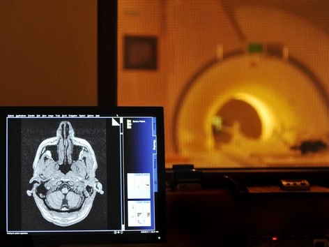 Жители Альберты с диагнозом рак могут частично оплачивать диагностическое сканирование даже после госкомпенсации